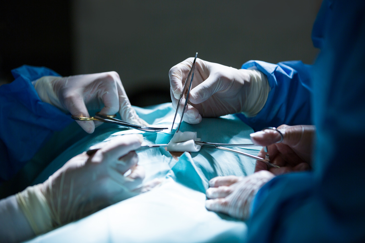 Cirurgia de vasectomia: o que é e como funciona