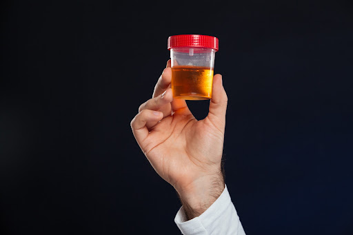 Sangue na urina: saiba como detectar e tratar