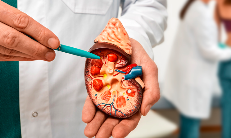 Câncer Renal: Opções de Tratamento e as Vantagens da Cirurgia Robótica